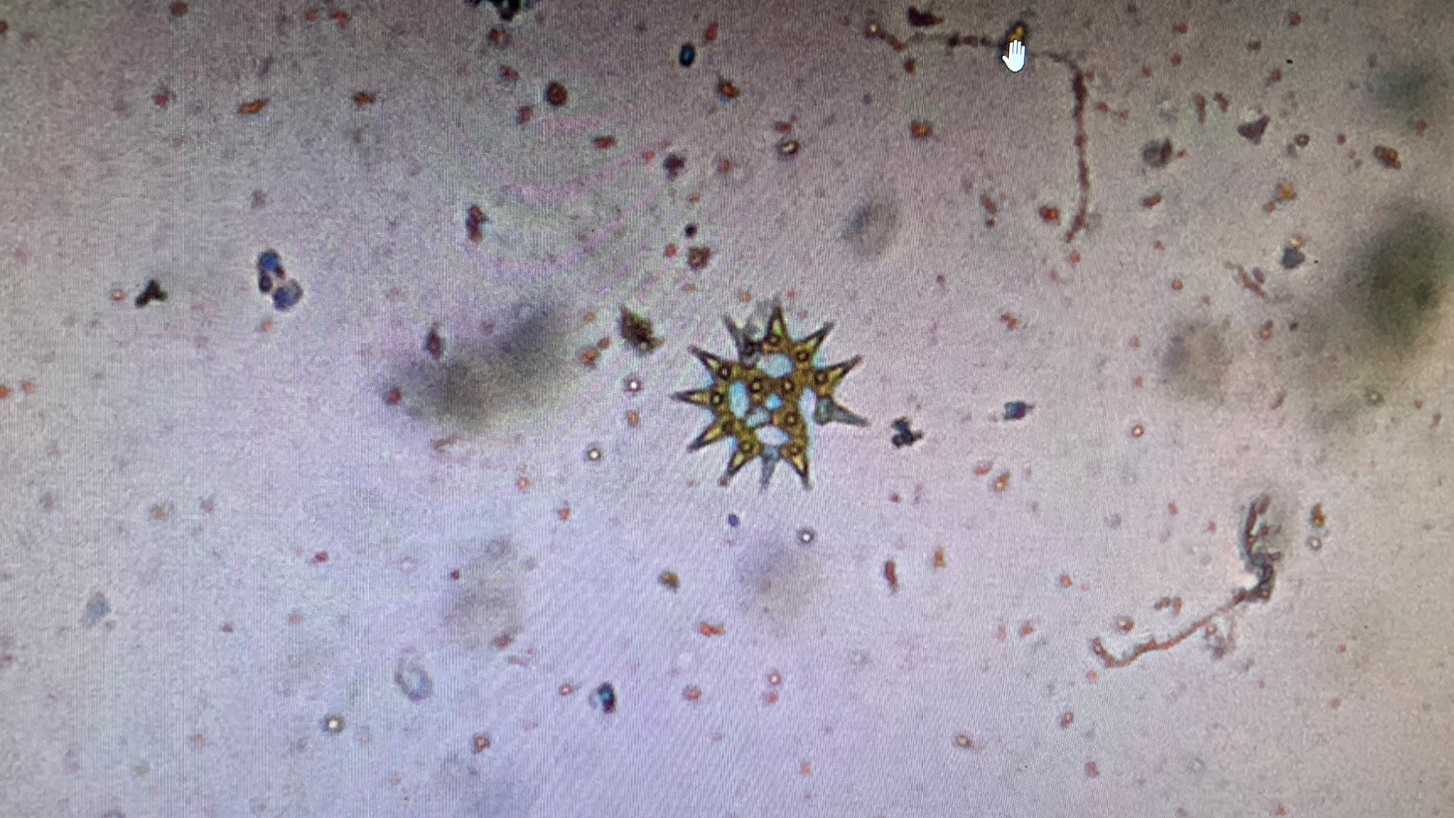 Descubra o mundo invisível do plâncton